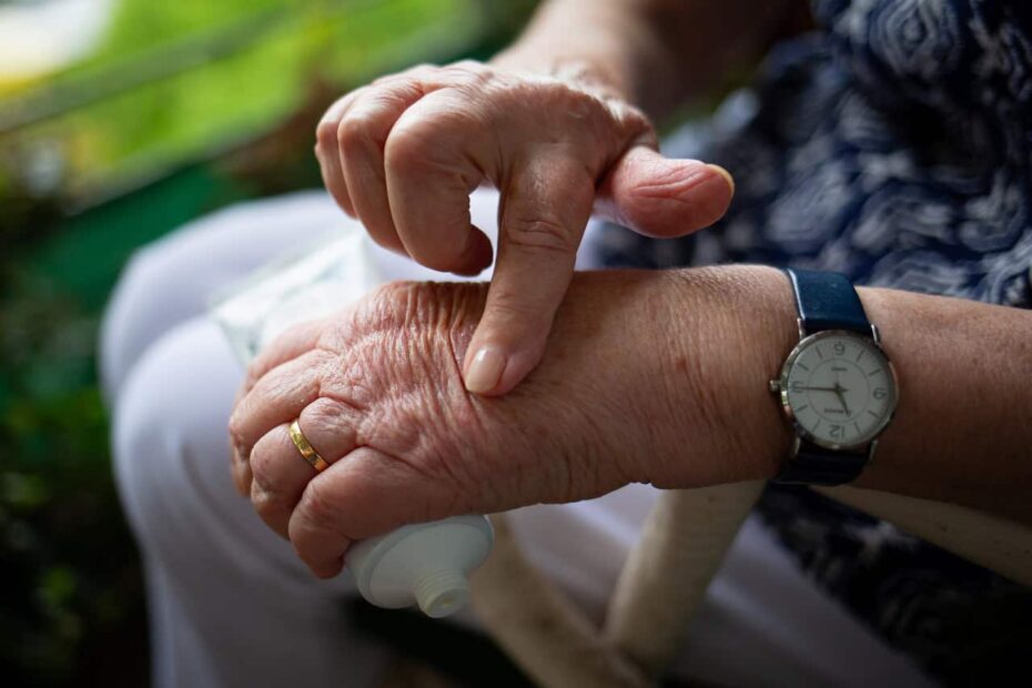 Physical Therapy for Rheumatoid Arthritis Treatment